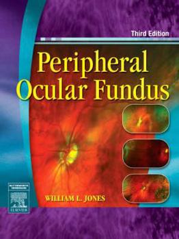 Hardcover Peripheral Ocular Fundus Book