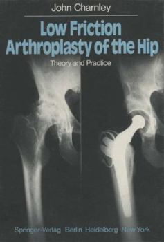 Paperback Low Friction Arthroplasty of the Hip: Theory and Practice Book