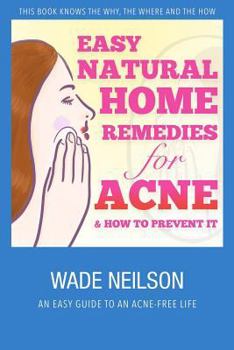 Paperback Acne: Easy Natural Home Remedies for Acne & How to Prevent It Book