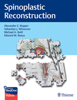 Hardcover Spinoplastic Reconstruction Book