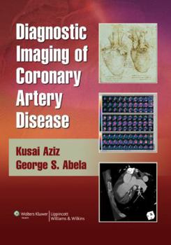 Hardcover Diagnostic Imaging of Coronary Artery Disease [With Online Access] Book