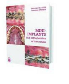Hardcover Mini-Implants: The Orthodontics of the Future Book