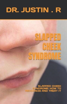 Paperback Slapped Cheek Syndrome: Slapped Cheek Syndrome: How to Recognize and Treat It Book