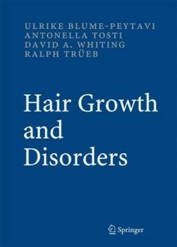 Hardcover Hair Growth and Disorders Book
