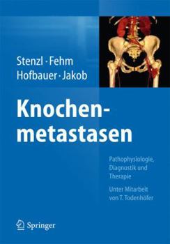 Hardcover Knochenmetastasen: Pathophysiologie, Diagnostik Und Therapie - Unter Mitarbeit Von T. Todenhöfer [German] Book