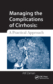 Paperback Managing the Complications of Cirrhosis: A Practical Approach Book
