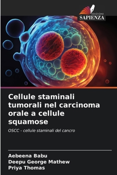 Paperback Cellule staminali tumorali nel carcinoma orale a cellule squamose [Italian] Book