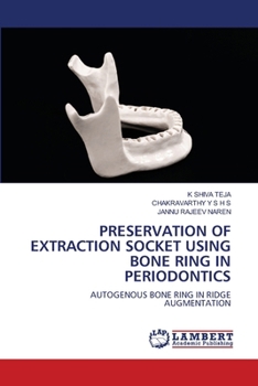 Preservation of Extraction Socket Using Bone Ring in Periodontics
