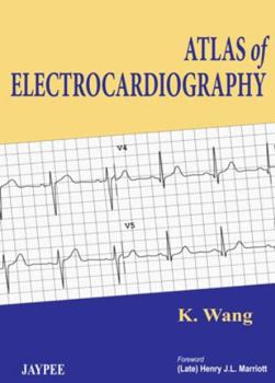 Paperback Atlas of Electrocardiography Book