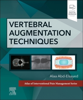 Hardcover Vertebral Augmentation Techniques Book