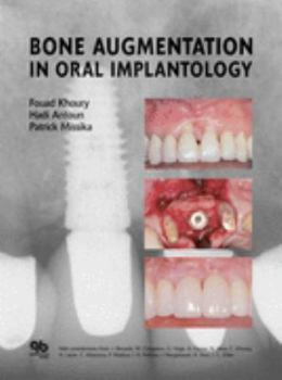 Hardcover Bone Augmentation in Oral Implantology Book