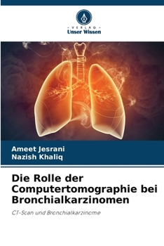 Paperback Die Rolle der Computertomographie bei Bronchialkarzinomen [German] Book