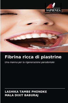 Paperback Fibrina ricca di piastrine [Italian] Book