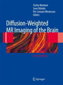 Paperback Diffusion-Weighted MR Imaging of the Brain Book