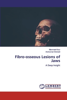 Paperback Fibro-osseous Lesions of Jaws Book