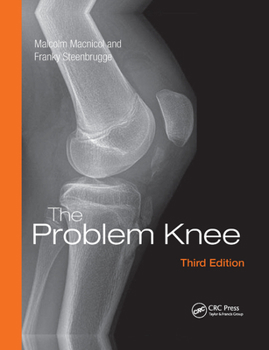 Paperback The Problem Knee Book