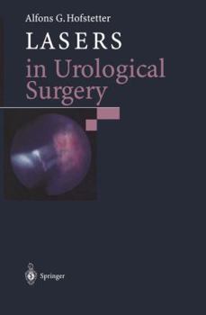 Paperback Lasers in Urological Surgery Book