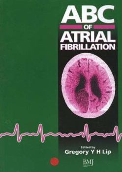 Paperback ABC of Atrial Fibrillation (ABC Series) Book