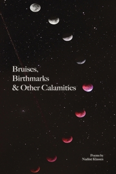Paperback Bruises, Birthmarks & Other Calamities Book