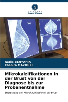 Mikrokalzifikationen in der Brust von der Diagnose bis zur Probenentnahme (German Edition)
