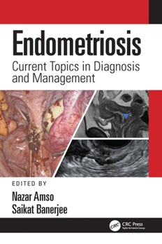 Hardcover Endometriosis: Current Topics in Diagnosis and Management Book
