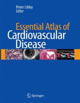 Hardcover Essential Atlas of Cardiovascular Disease [With CDROM] Book