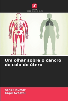 Paperback Um olhar sobre o cancro do colo do útero [Portuguese] Book