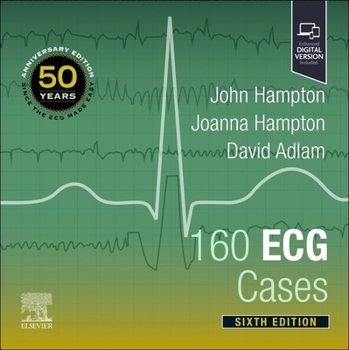 Paperback 160 ECG Cases Book