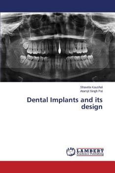 Paperback Dental Implants and Its Design Book