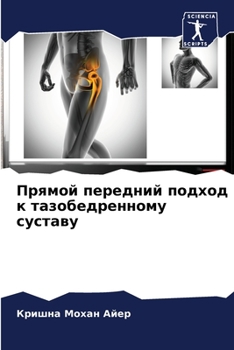 Прямой передний подход к