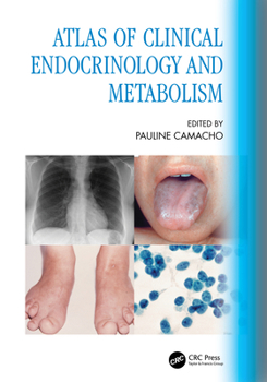 Paperback Atlas of Clinical Endocrinology and Metabolism Book
