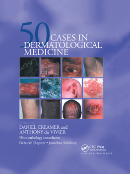 Paperback Fifty Dermatological Cases Book