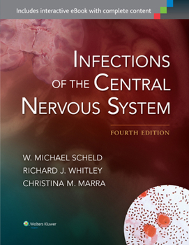 Hardcover Infections of the Central Nervous System Book
