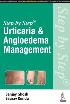 Paperback Step by Step: Urticaria & Angioedema Management Book