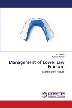 Paperback Management of Lower Jaw Fracture Book
