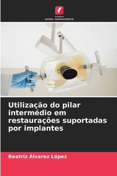 Paperback Utilização do pilar intermédio em restaurações suportadas por implantes [Portuguese] Book