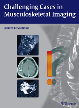 Hardcover Challenging Cases in Musculoskeletal Imaging Book