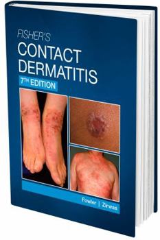 Unknown Binding Fisher’s Contact Dermatitis 7th Edition Book