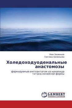 Paperback Kholedokhoduodenal'nye Anastomozy [Russian] Book