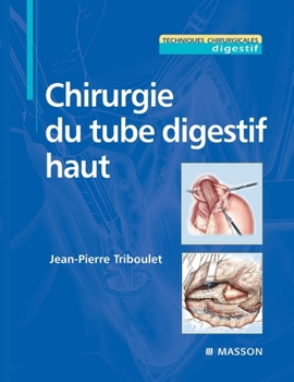 Paperback Chirurgie Du Tube Digestif Haut [French] Book