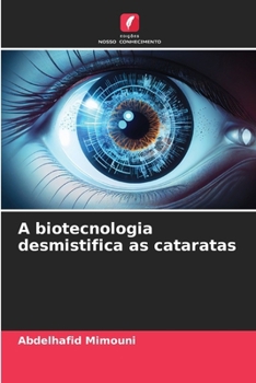 A biotecnologia desmistifica as cataratas (Portuguese Edition)