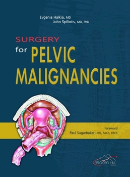 Paperback Surgery for Pelvic Malignancies Book