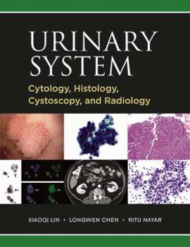 Hardcover Atlas of Cystoscopic and Pathologic Findings in the Urinary Tract Book