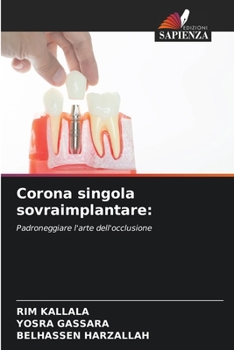 Paperback Corona singola sovraimplantare [Italian] Book