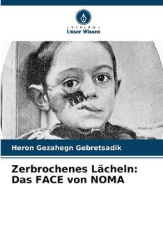 Paperback Zerbrochenes Lächeln: Das FACE von NOMA [German] Book