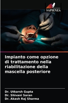 Paperback Impianto come opzione di trattamento nella riabilitazione della mascella posteriore [Italian] Book