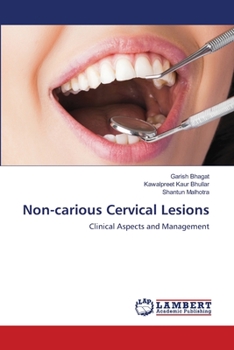 Paperback Non-carious Cervical Lesions Book