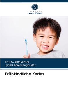 Paperback Frühkindliche Karies [German] Book