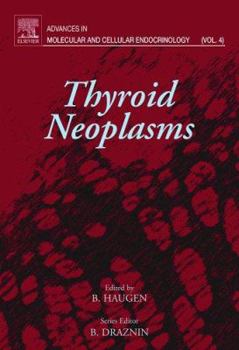 Hardcover Thyroid Neoplasms Book