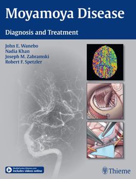 Hardcover Moyamoya Disease: Diagnosis and Treatment Book